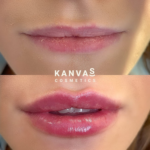 Kanvas Medical Group | Non-surgical Aesthetics Treatments
