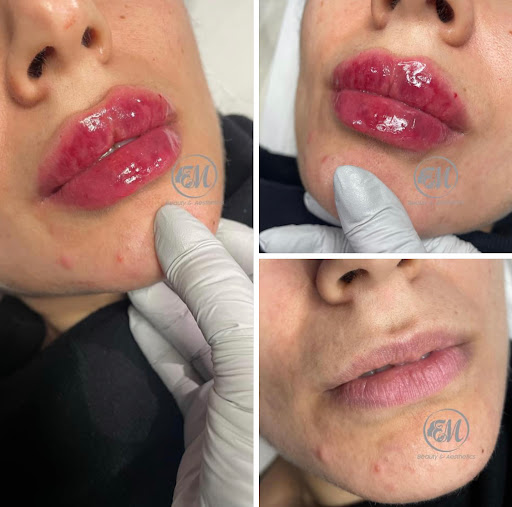 EM beauty & aesthetics