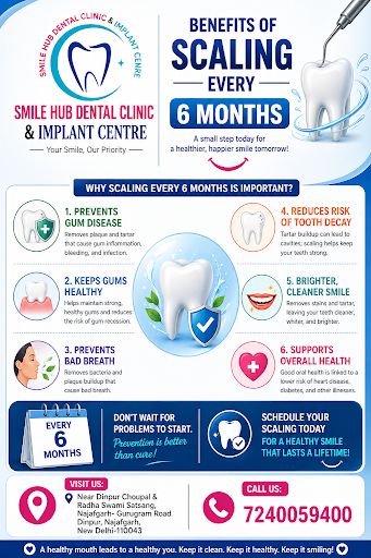 **Why Dental Scaling Every 6 Months?** post image