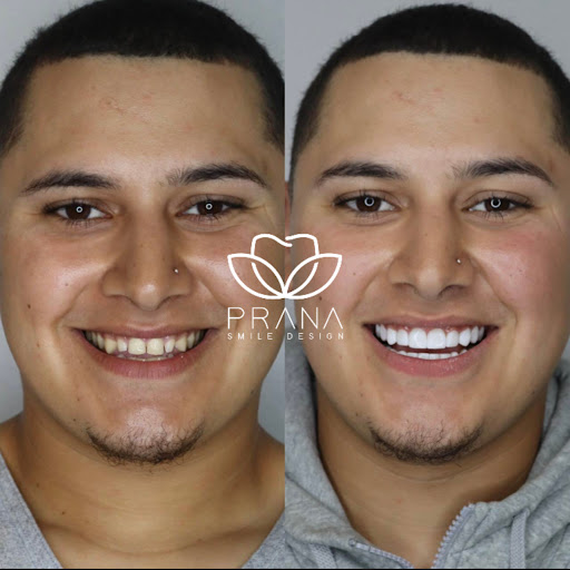 Prana Smile Design - Thumbnail