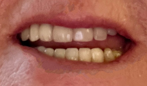 The Dental Design Studio - Cliff Road Gallery - United Kingdom