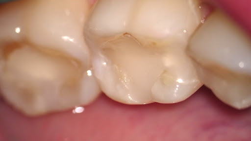 Zahnarzt - Costin Marinescu, Dr-Medic Stom, DDS - Advanced Aesthetic and Preventive Dentistry - Thumbnail