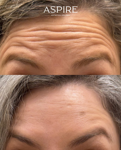 Aspire Aesthetics & Wellness Clinic