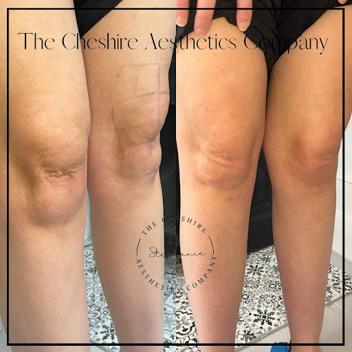 The Cheshire Aesthetics Company - Thumbnail