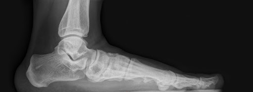 On The Go Toes Podiatry & Wound Care Center - Thumbnail