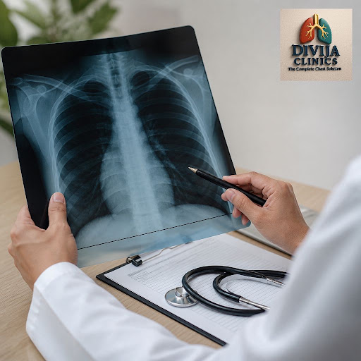 Regular TB monitoring is crucial to prevent serious lung damage and ensure full recovery. At DIVI… post image