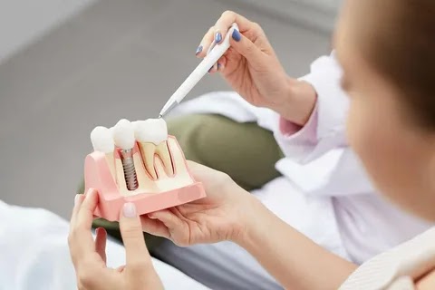 Every implant procedure begins with a detailed assessment of jawbone health and gum condition. Un… post image