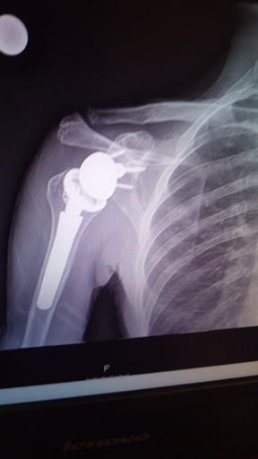 Select Physical Therapy - Lemoyne - Thumbnail