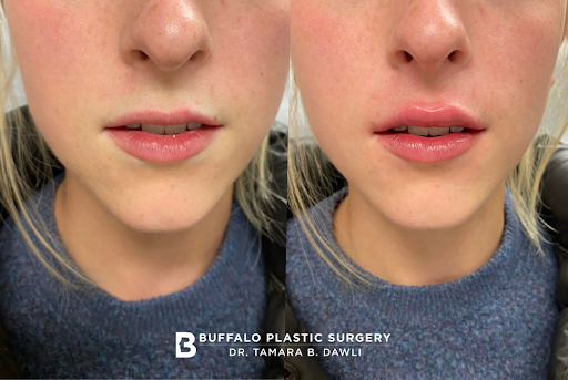 The Medical Spa @BuffaloPlasticSurgery