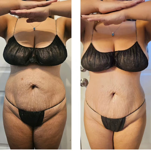 Make Me Shapely - Visual