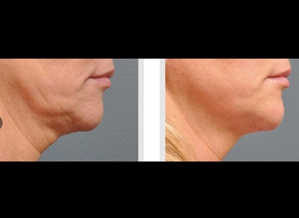 https://www.beautymedestetic.pl/