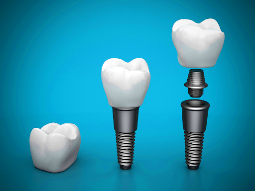 Pelham Smiles Family Dentistry