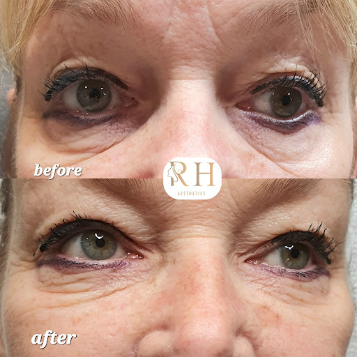 Rachel Hawkswell Aesthetics