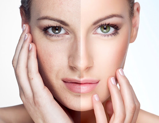 Radiant Skin Penampang