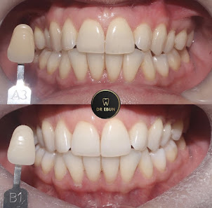 Rainworth Dental Care Sherwood Parade, Kirklington Rd, Rainworth, Mansfield NG21 0JP, United Kingdom