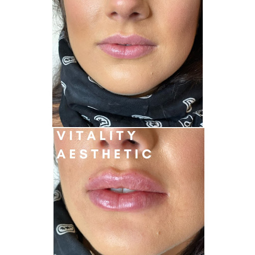 Vitality Aesthetics