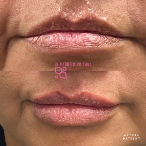 NP Aesthetics Las Vegas