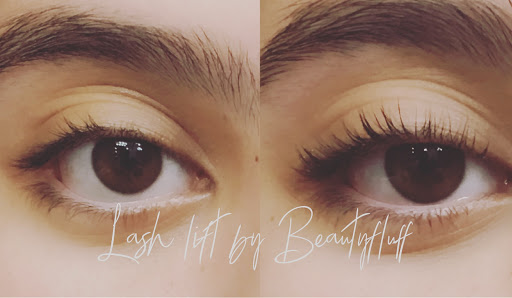 BEAUTYFLUFF Medical and Wellness - Thumbnail