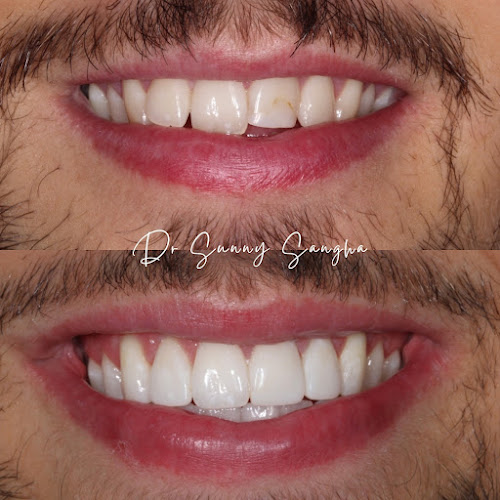 Smmmile - Invisalign Newcastle - Newcastle upon Tyne