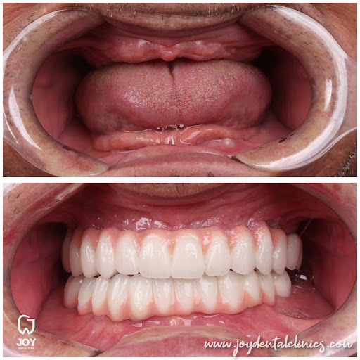 DentoShape Dental clinic Dr. Amgad Hassan Soliman د.أمجد حسن سليمان - صورة 7