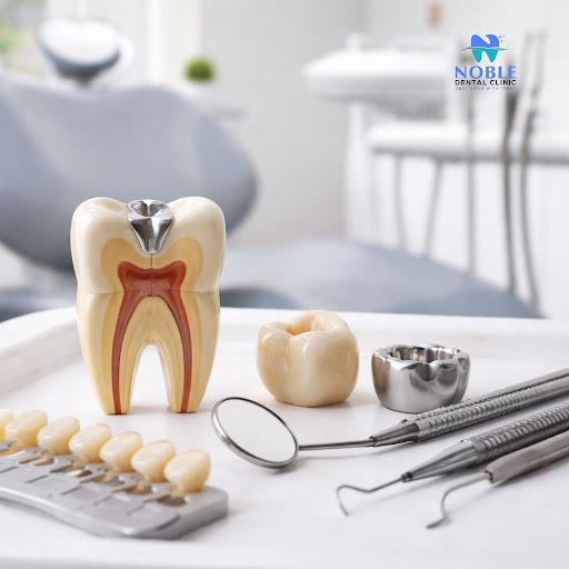 Thinking about dental fillings or crowns and feeling a bit nervous? At Noble Dental Clinic in Sak… post image