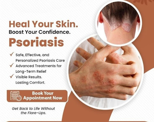 Struggling with itchy, red, or flaky skin patches? post image