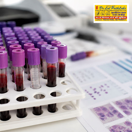 A Complete Blood Count (CBC) is one of the most important routine tests to track your overall hea… post image