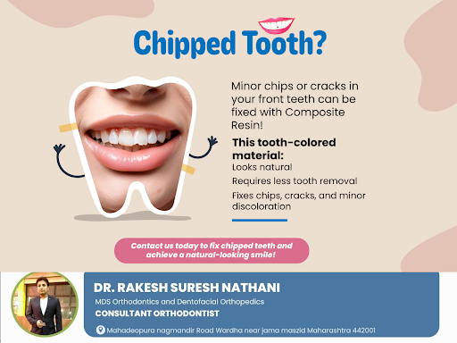 A chipped tooth doesn't have to affect your smile! Composite resin offers a seamless, naturallook… post image