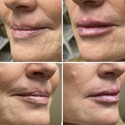 Silk Touch Cosmetic Surgery, Lipo, & Medspa