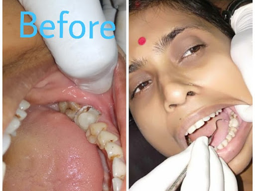 Discount on every treatment.. post image