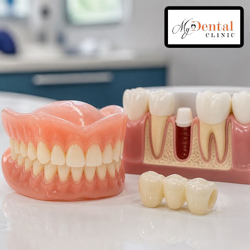 Regain your confident smile with customised dentures and dental bridges at My Dental Clinic - Dr.… post image