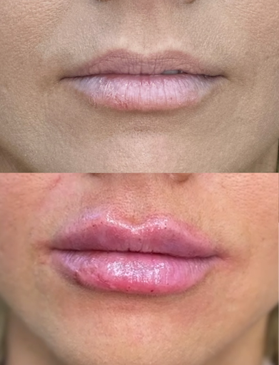 Nude Aesthetics Med Spa Scottsdale