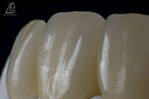 Scuola di Modellazione Dentale Afg - Thumbnail