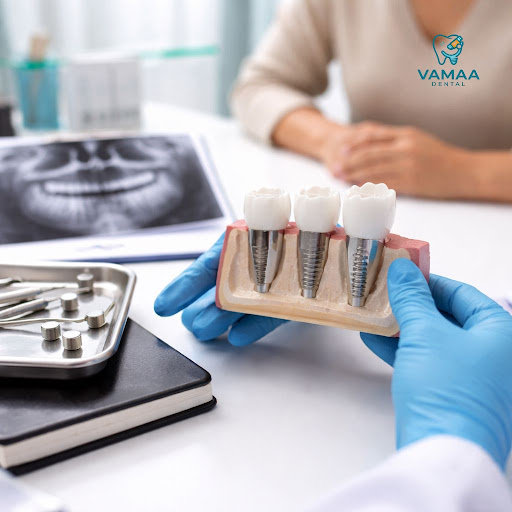 Thinking about dental implants to replace missing teeth? At Vamaa Dental Clinic and Microscopic c… post image