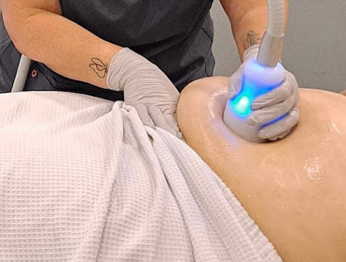 Lipo Lounge Jax by null