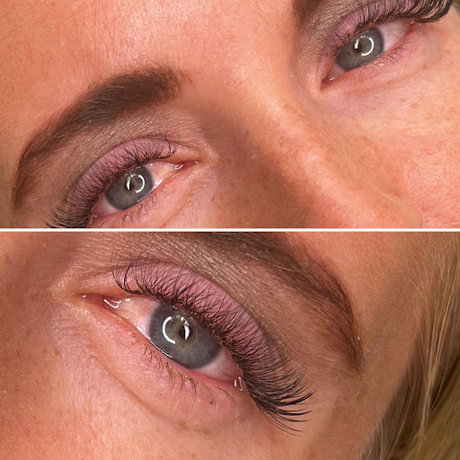 Darlène esthetik' - Thumbnail