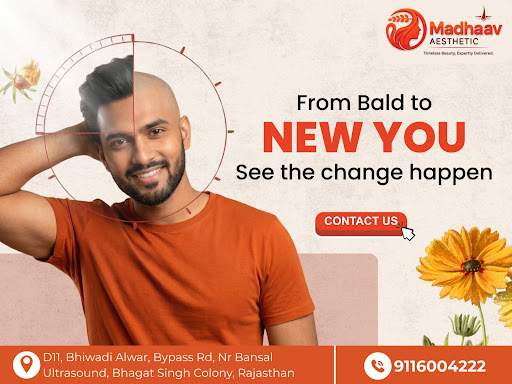 best hair transplant in bhiwadi