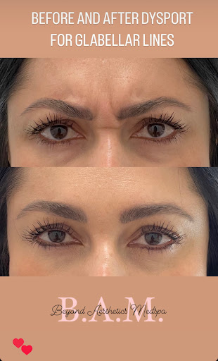 Beyond Aesthetics Medspa (BAM) - Thumbnail