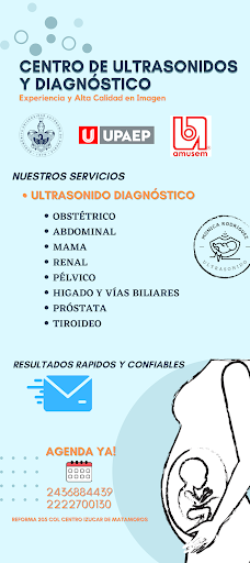 Ultrasonido Diagnóstico Ultra-Medic Izucar - Thumbnail