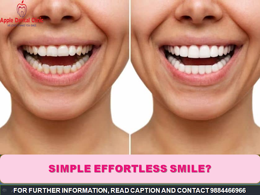 If you’re not feeling confident with your smile, or wish to improve it, there are an array of cos…