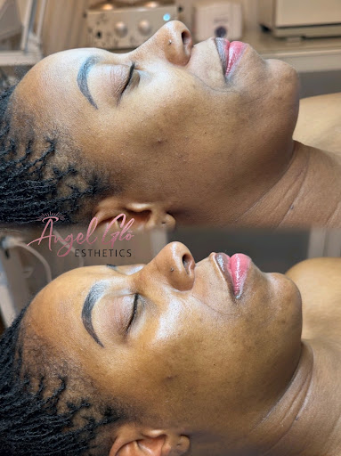Angel Glō Skincare - Thumbnail