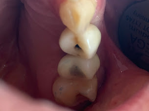 Photo n°12 de Dr Guittard Olivier à Canet-en-Roussillon (Dentiste)