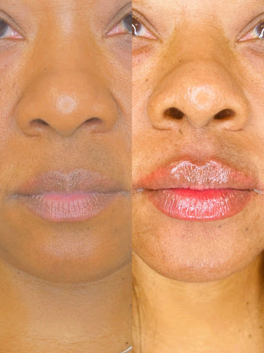 SkinVana Medspa