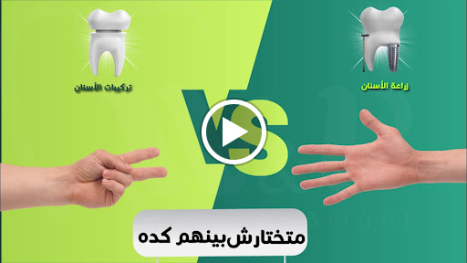 عيادة د.عمرو علاء الدين السباعي، طبيب أسنان بمستشفى مدينة نصر التخصصي - صورة 6