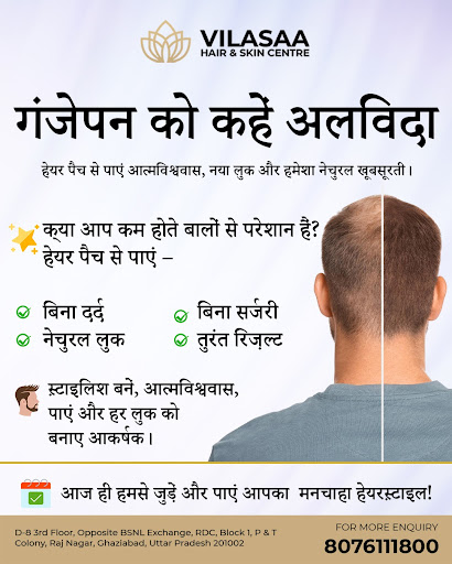 Best Hair Patch Services in RDC Raj Nagar, Ghaziabad