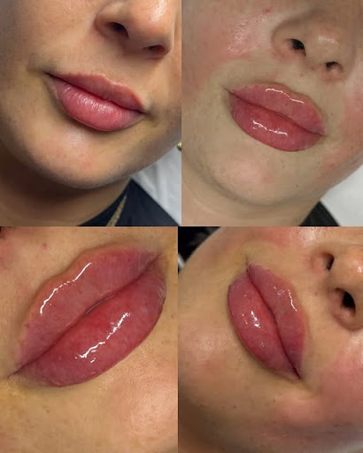 Illume Beauty Aesthetics Skin