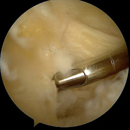 Photo n°20 de Docteur Murgier Jérôme à Biarritz (Chirurgien orthopédiste)