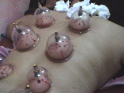 Photos of klinik bekam assyarif