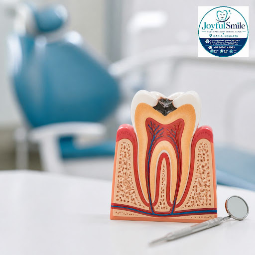 Still scared of root canal treatment because of old horror stories? At Joyfulsmile Multispecialit… post image