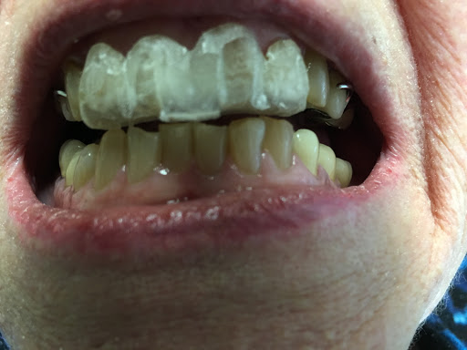 Dr. Mike Pilar, TMJ Specialist - Thumbnail